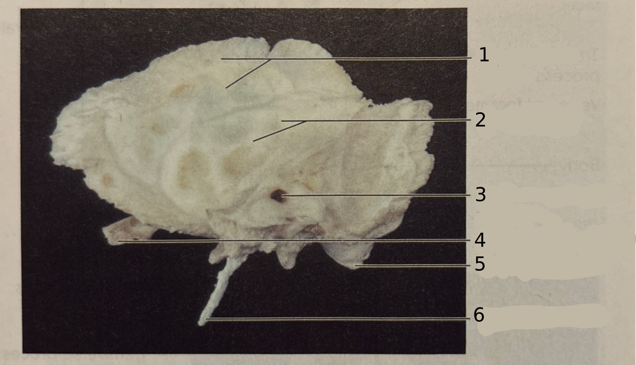 <p>#5</p>