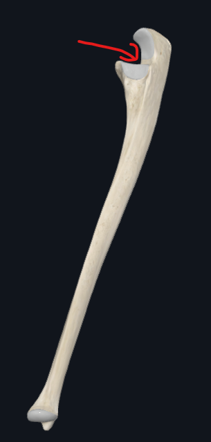 <p>What is this part of the ulna called</p>