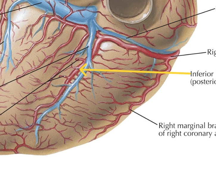 <p>Which heart circulation:</p><ul><li><p>From right coronary artery feeds ventricles</p></li></ul><p></p>