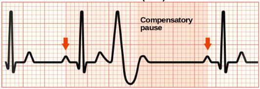 <p>What ECG trace is this?</p>