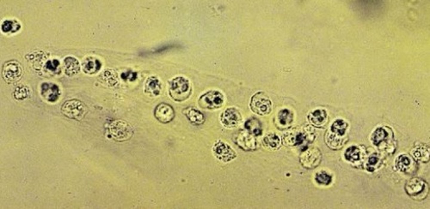 <p>What is being shown histologically?</p>