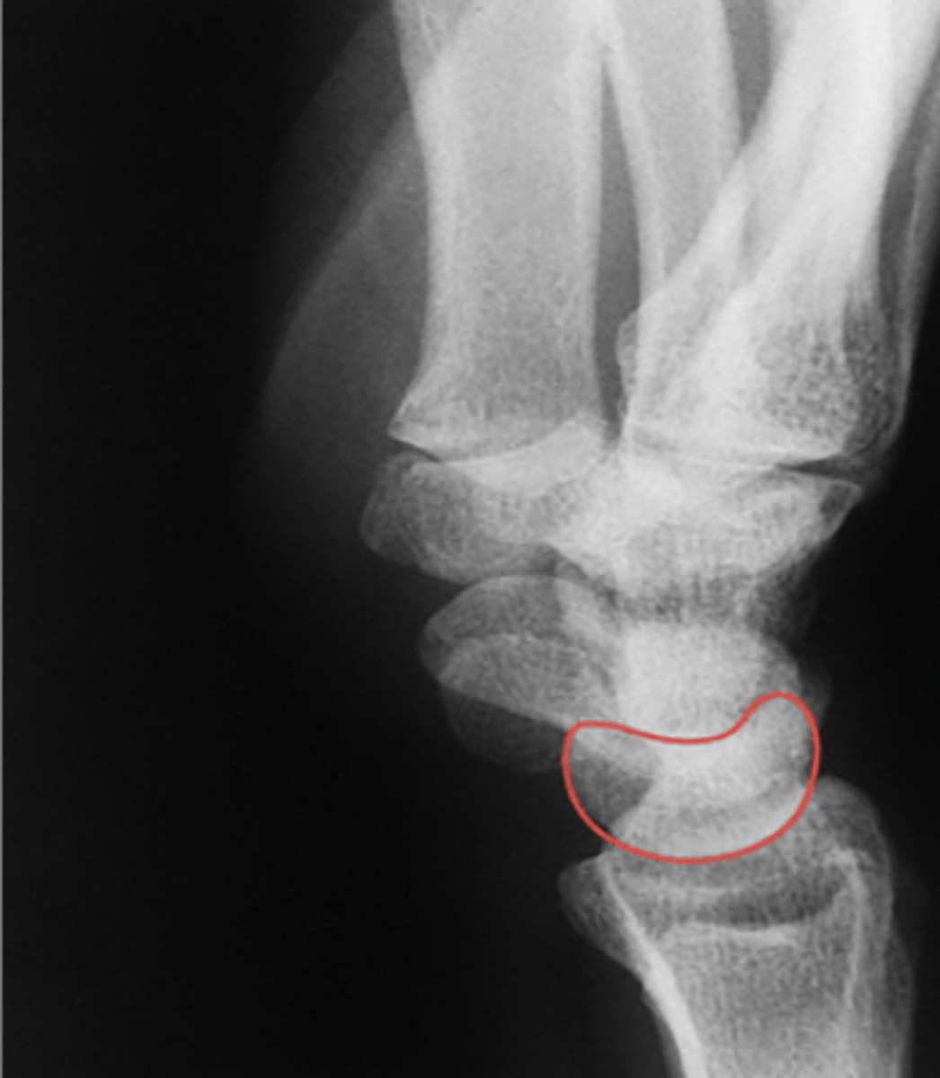 <p>What structure is highlighted?</p>