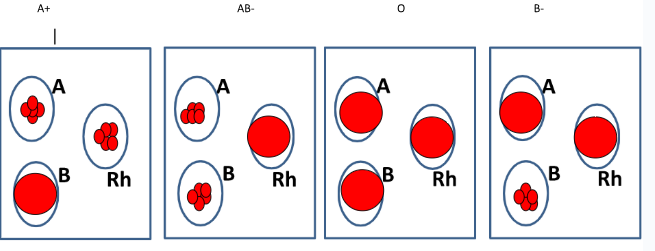 <p>The individual has that blood type </p>