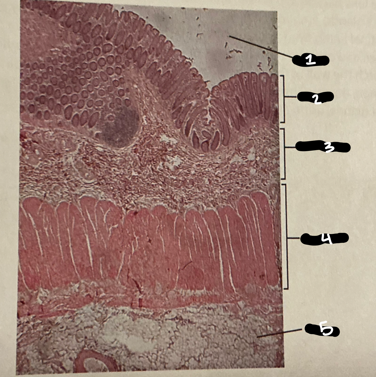 term image