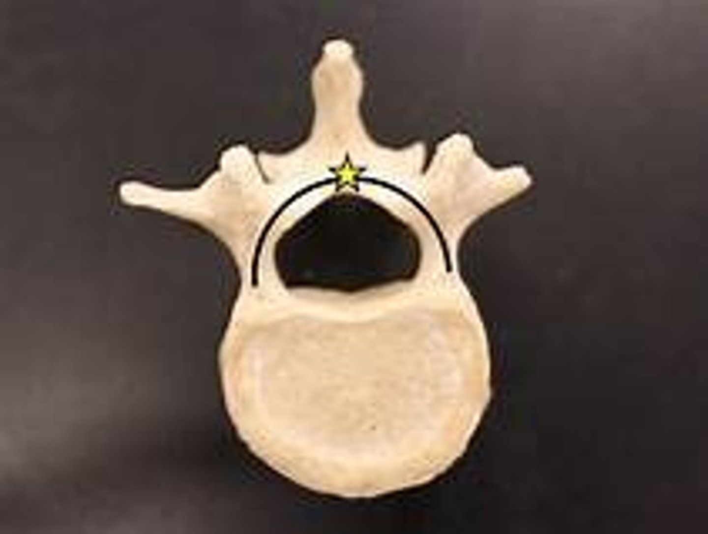 <p>Of the Vertebrae. The arch made by the Pedicle and the Lamina of the bone.</p>