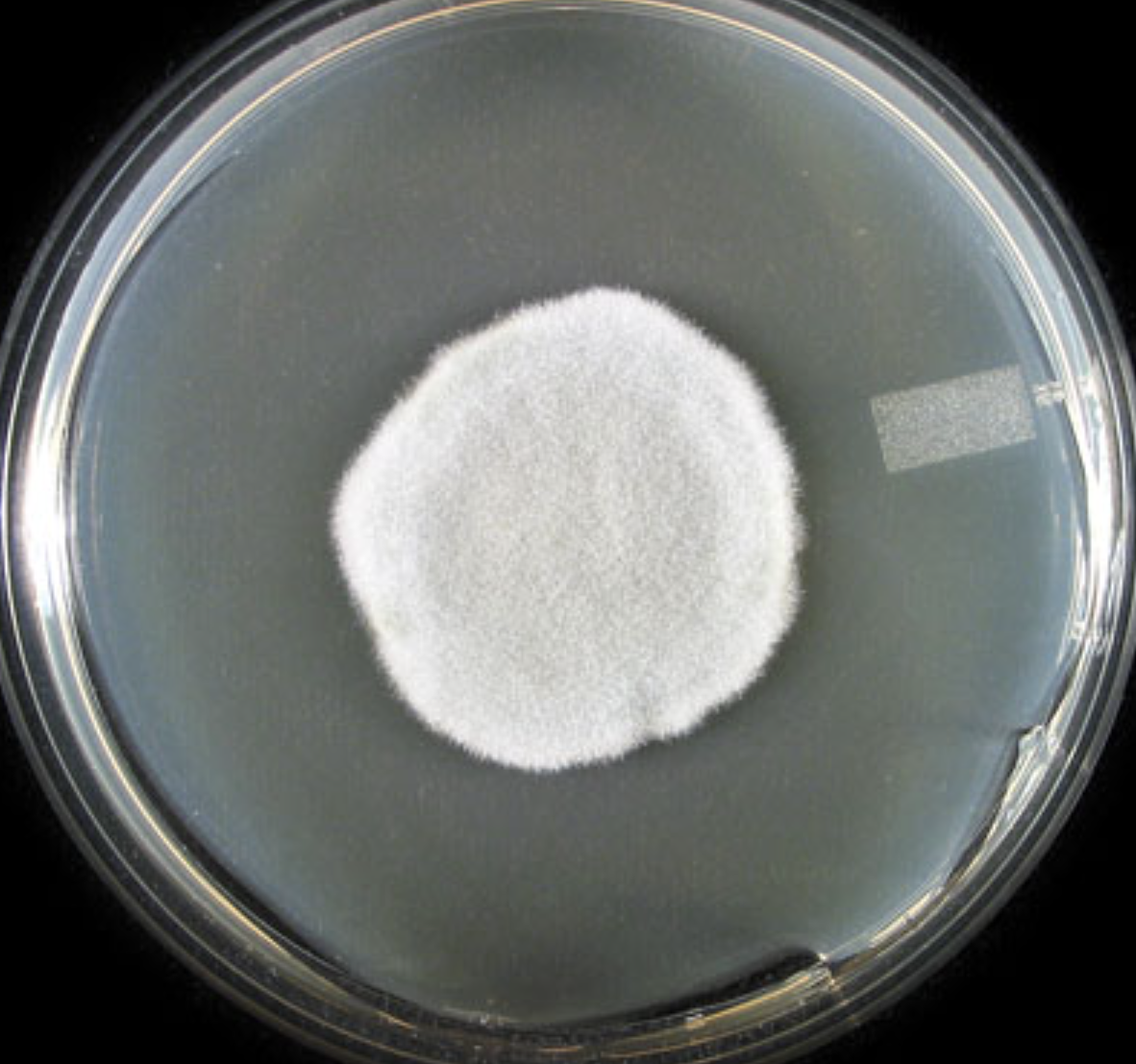 <p>What organism is this? Obverse or reverse?</p>