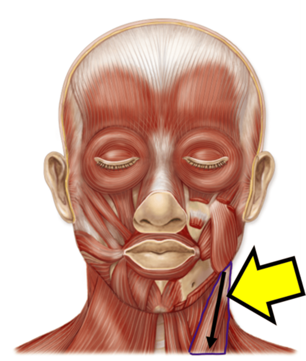 <p>Name the muscle</p>
