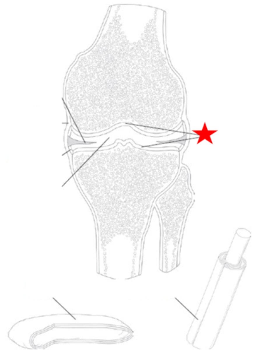 <p>Identify the synovial joint structure that the star is pointing to.</p>