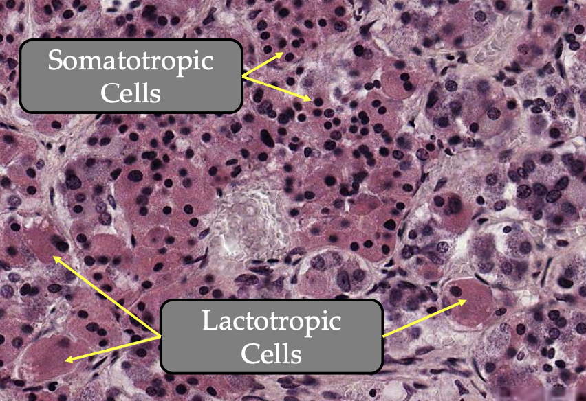 <p><strong>Somatotropic cells:</strong></p><ul><li><p><strong><u>Size:</u> Small</strong></p></li><li><p><strong><u>Shape:</u> Round</strong></p></li><li><p><strong><u>Consist of:</u> Large, densely packed granules</strong></p></li><li><p><strong><u>Secrete:</u> Growth hormone</strong></p></li></ul><p><strong>Lactotropic cells:</strong></p><ul><li><p><strong><u>Size:</u> Large, single </strong></p></li><li><p><strong><u>Shape:</u> Polyhedral </strong>cells</p></li><li><p><strong><u>Consist of:</u> Larger granules</strong></p></li><li><p><strong><u>Secrete:</u> Prolactin hormone</strong></p></li><li><p><strong><u>Prominent during:</u> Gestation </strong>and <strong>post partum </strong></p></li></ul><p></p>