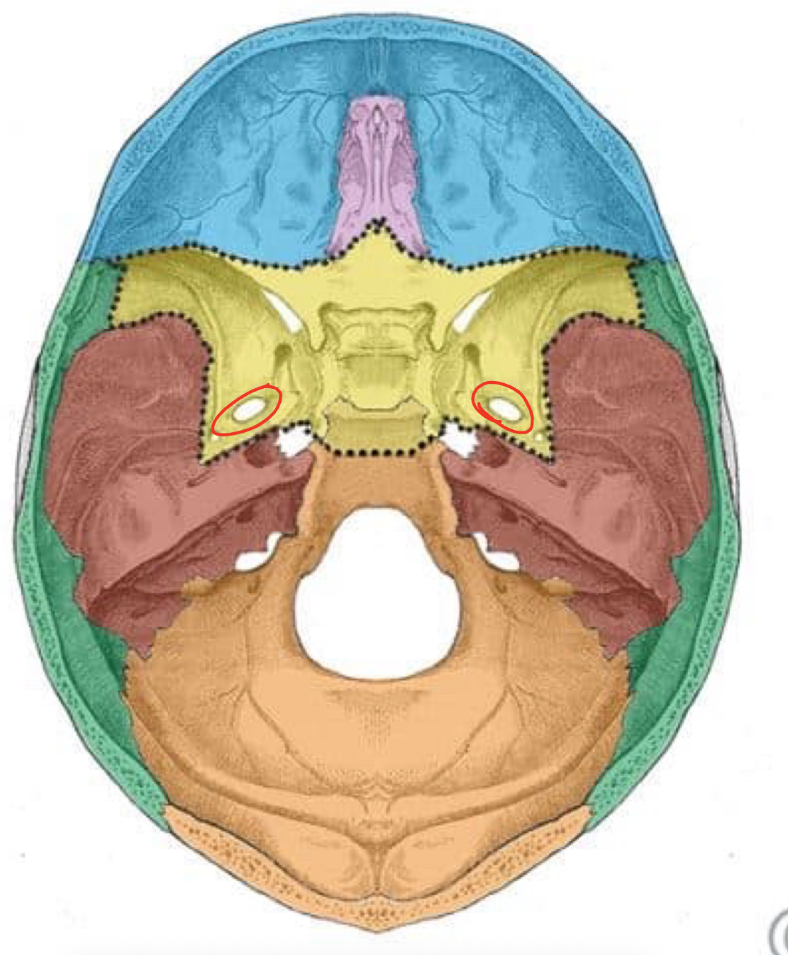 term image