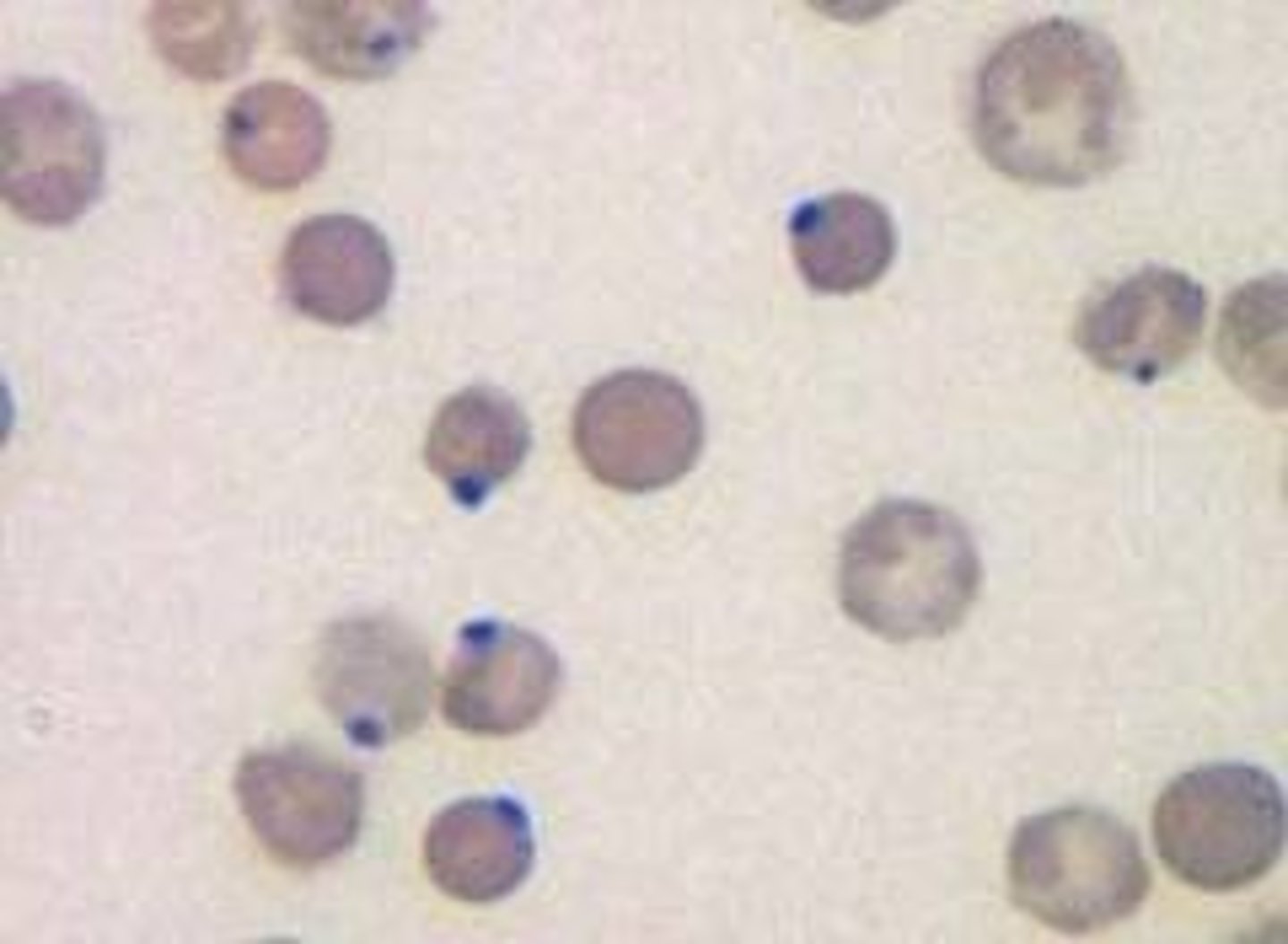 <p>round denatured hemoglobin inclusions that are bound to cell membrane; sign that RBC was exposed to oxidation</p>