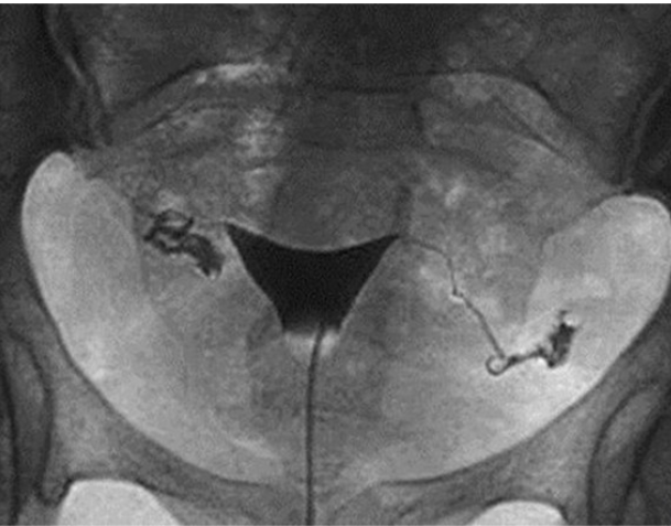 <p><span>What contrast procedure was performed to produce this image?</span><br></p>