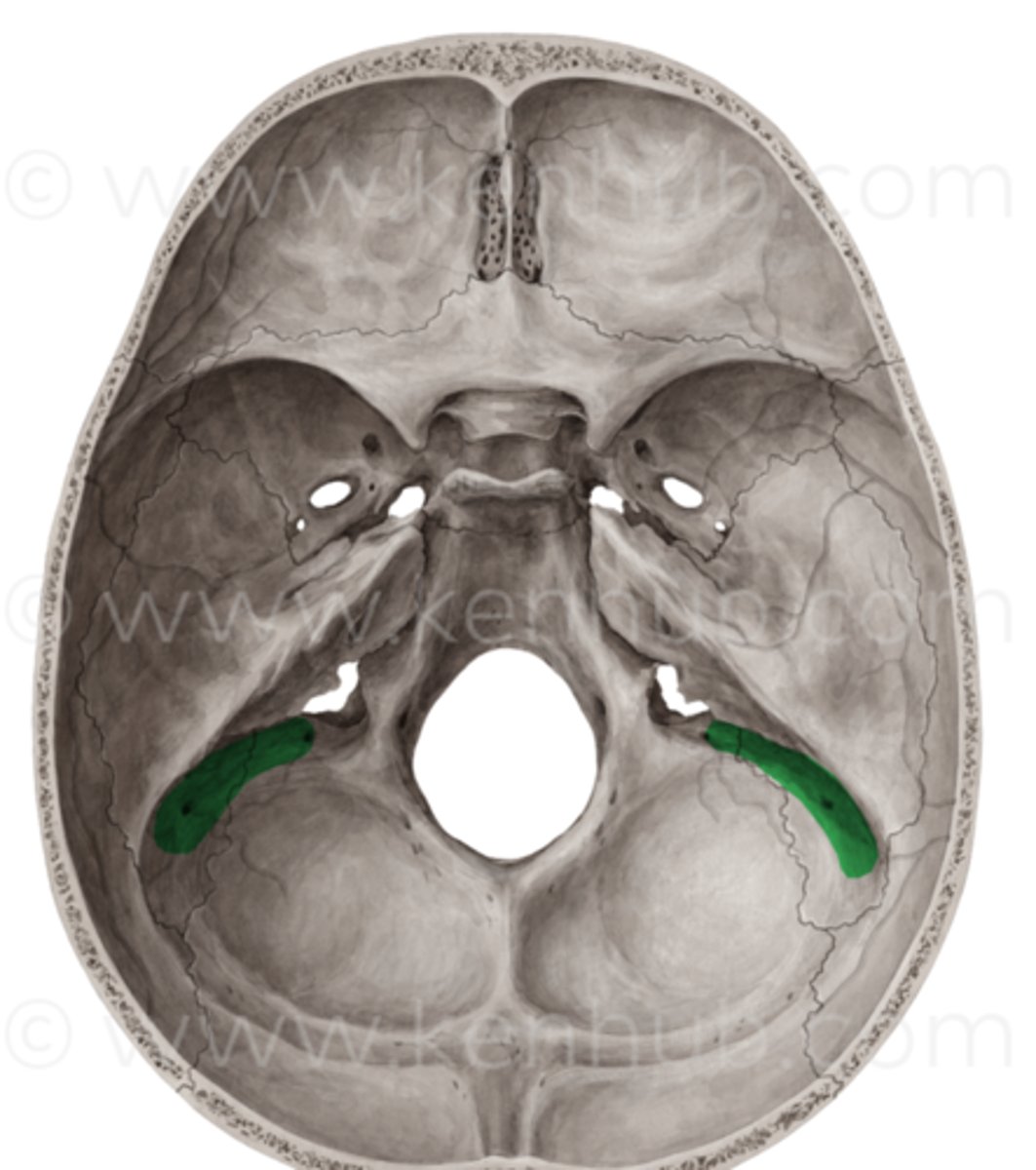 <p>Sits in the posterior cranial fossa</p><p>Heads down into the jugular foramen</p><p>Drains venous blood into the internal jugular vein</p>