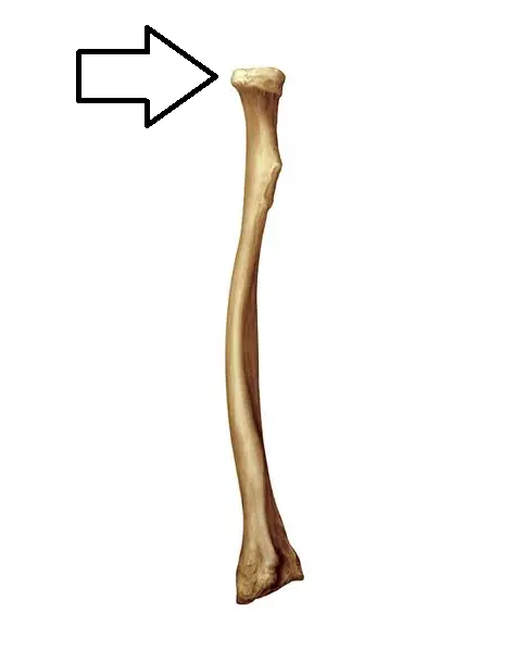 <p>what part of the radius is this?</p>
