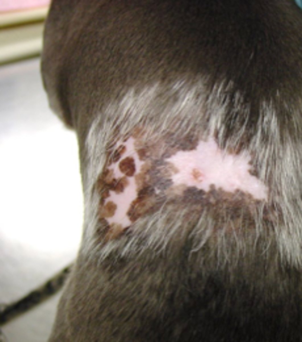<p>what type of hypersensitivity reaction causes ischemic dematopathy if this syndrome involves vasculitis of the cutaneous blood vessels due to antigen-antibody complex deposition?</p>