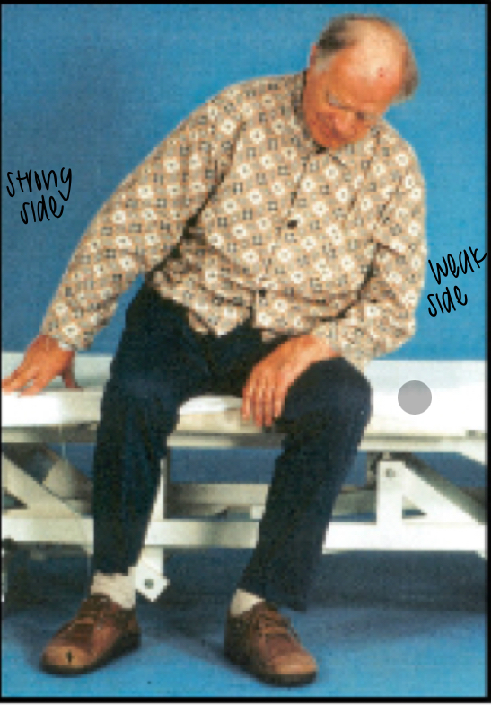 <p>a condition following a stroke or TBI where the patient pushes away from the non-paretic side towards the paretic side, leading to a tilted posture and a loss of balance</p>
