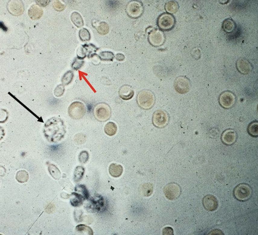 <p><span style="color: #000000">What is the </span><span style="color: #000000">red</span><span style="color: #000000"> arrow pointing to &amp; what is it doing?</span></p><p><span style="color: #000000">What is the back arrow pointing to?</span></p>