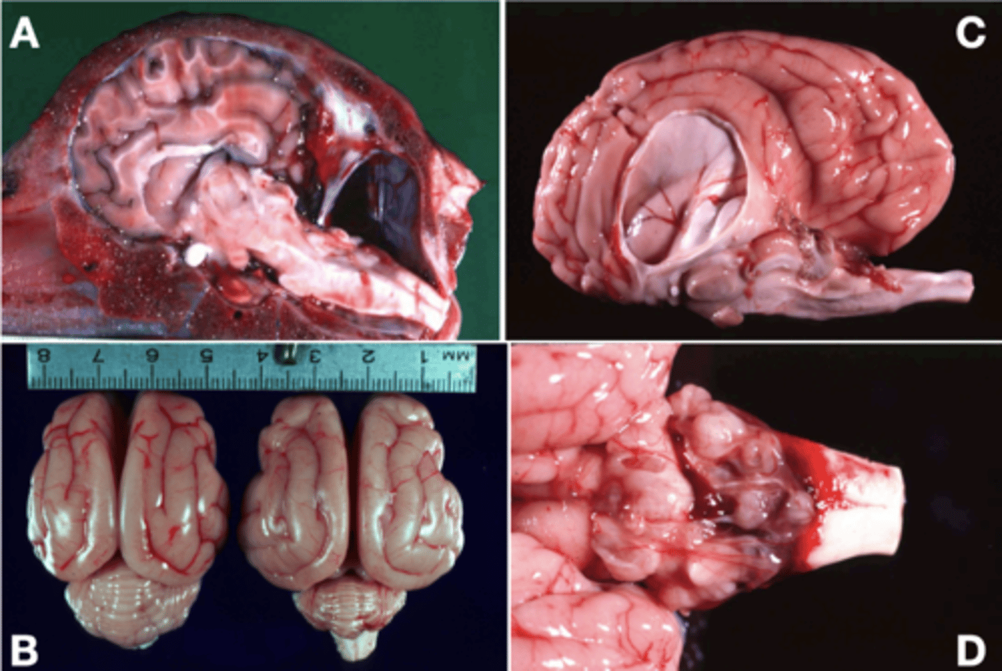 <p>- Due to extensive postnatal development of the cerebellum. In animals, most cases are associated with in utero viral infection</p>