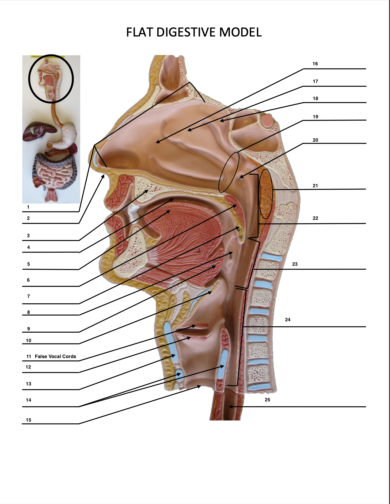 <p>False Vocal Cords</p>