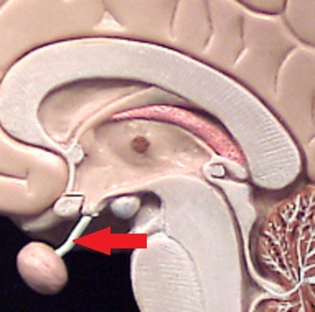 <p>connects hypothalamus to pituitary gland</p>