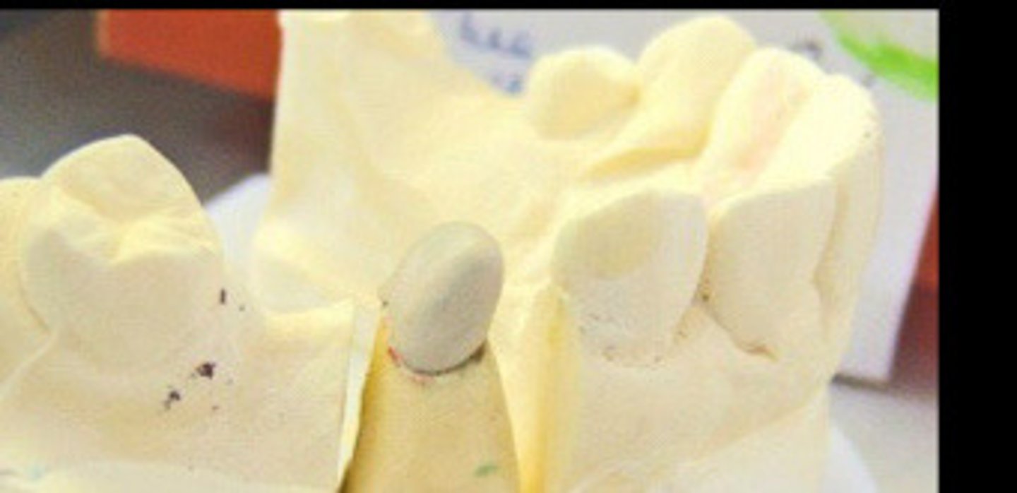 <p>3) __ is added on top of coping</p>