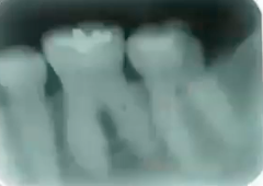 <p>diagnosis? </p>
