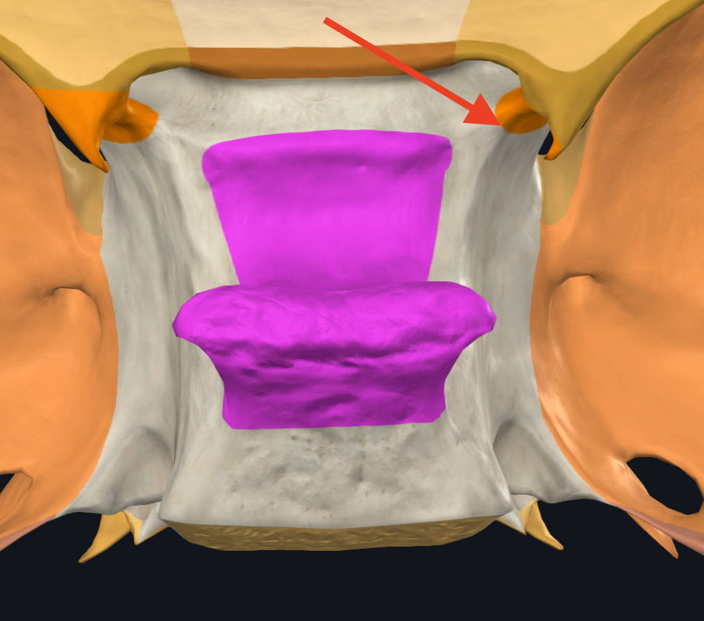 <p><span>anterior clinoid processes </span><span style="font-family: Calibri, sans-serif"> </span></p>