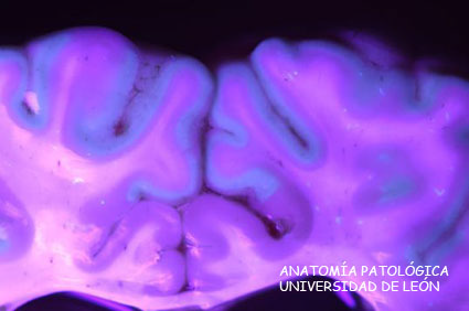 <p>Necrosis cerebrocortical. Ovino.</p>