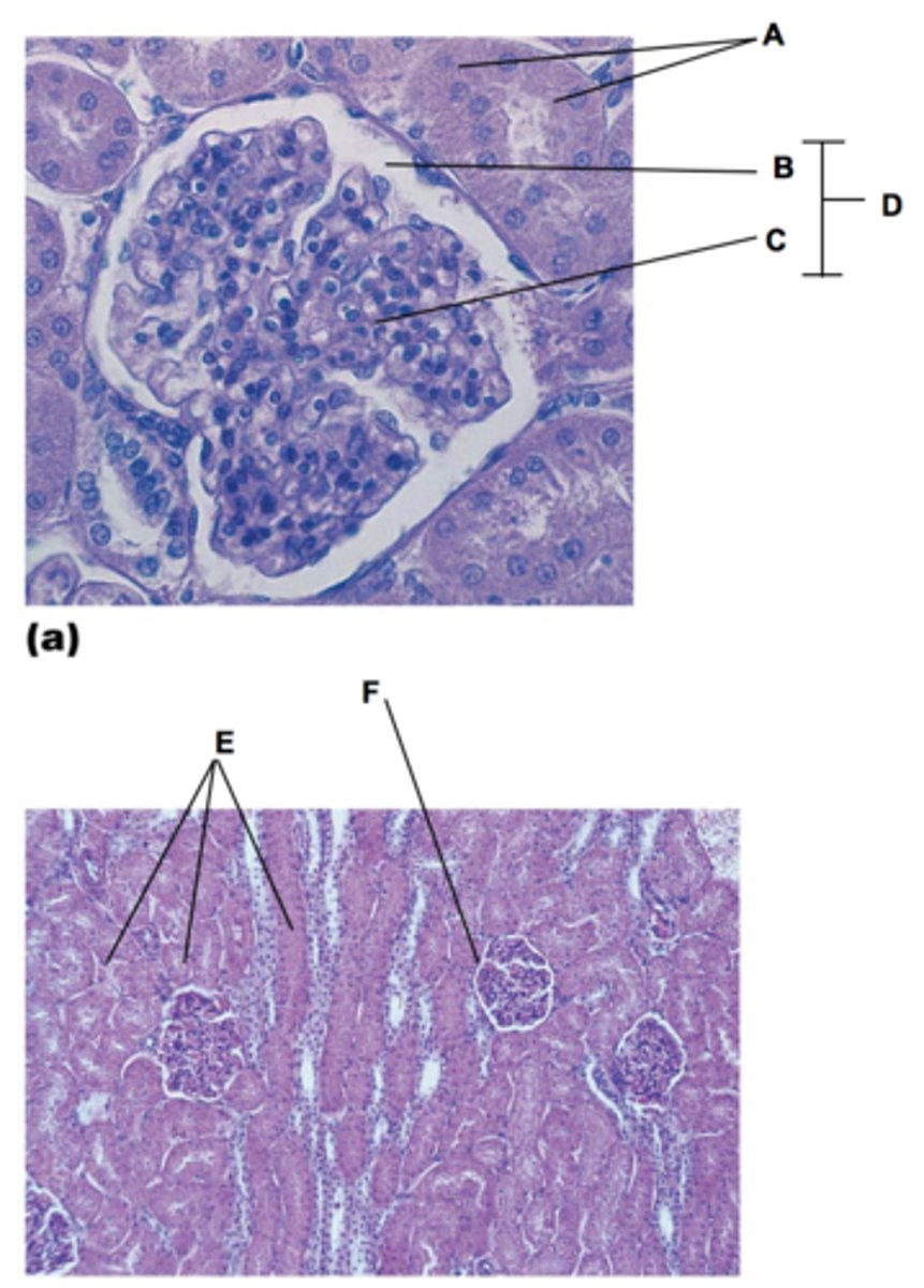<p>Identify this urinary system structure (A)</p>
