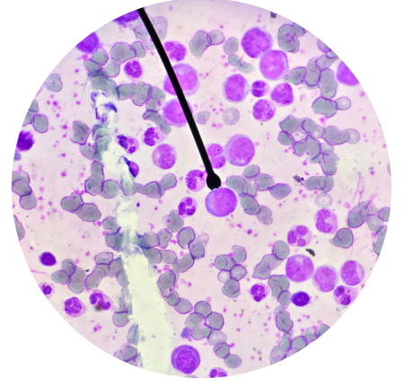 <p>what kind of white blood cells is this?</p>