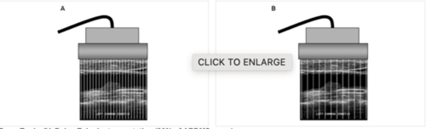 <p>Interpolation</p>
