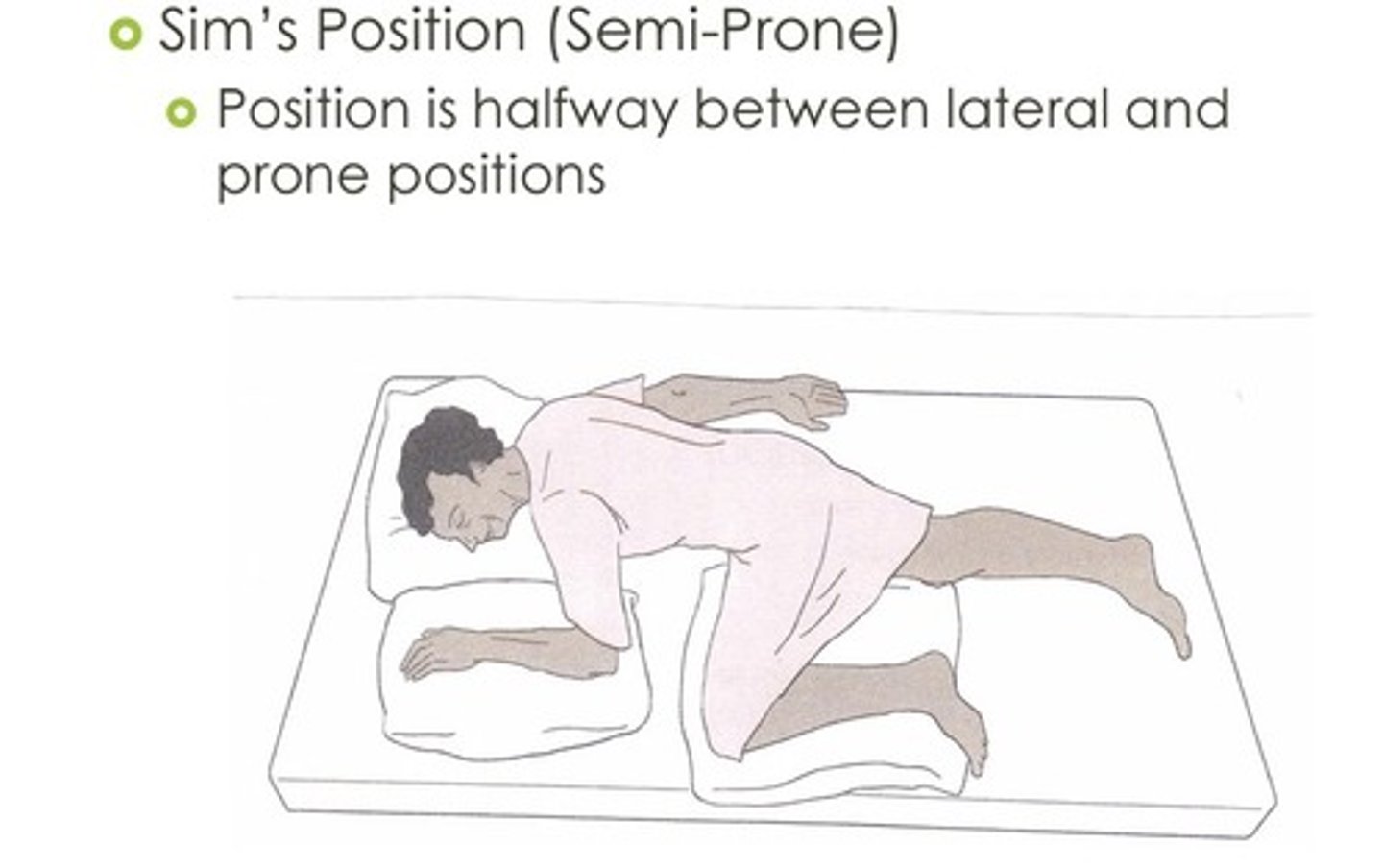 <p>A body position in which a person is lying on his left side with the upper knee flexed and raised toward the chest</p>