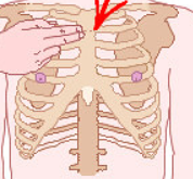 <ul><li><p>AKA angle of louis</p></li><li><p>between manubrium and body</p></li></ul><p></p>