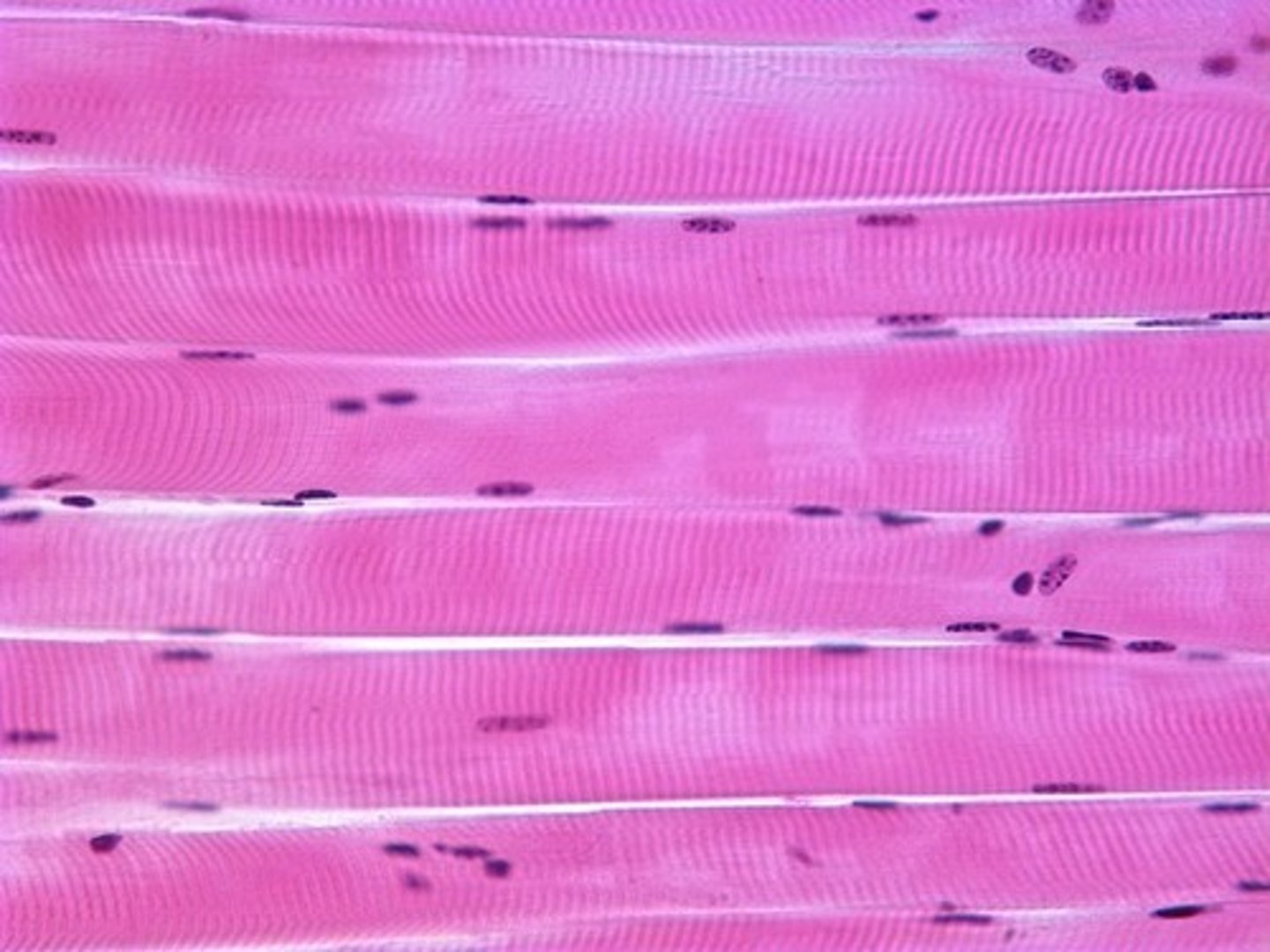 <p>Voluntary muscle attached to bones, with long parallel fibers, multinucleated cells, and striations.</p>