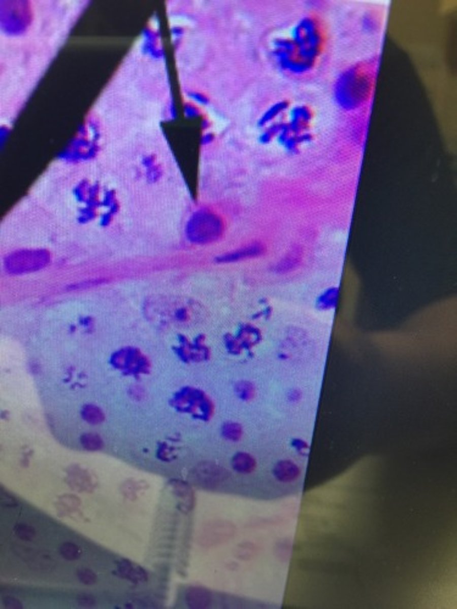 <p>A cell produced at an early stage in the formation of spermatozoa, formed in the wall of the seminiferous tubule.</p>