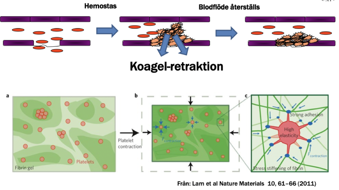 <p>Det sker <strong>koagel-retraktion</strong>; trombocyterna kontraherar med hjälp av fibrinogenreceptorn <strong>GpIIb/GpIIIa</strong>  och fibrinet dras ihop. Det gör tromben mer kompakt för att återskapa ett blodflöde i kärlet och göra tromben mer elastisk.</p>