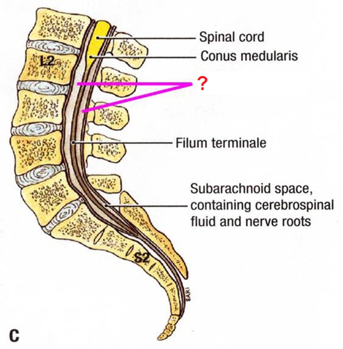 <p>subarachnoid space inferior to conus medullaris</p>