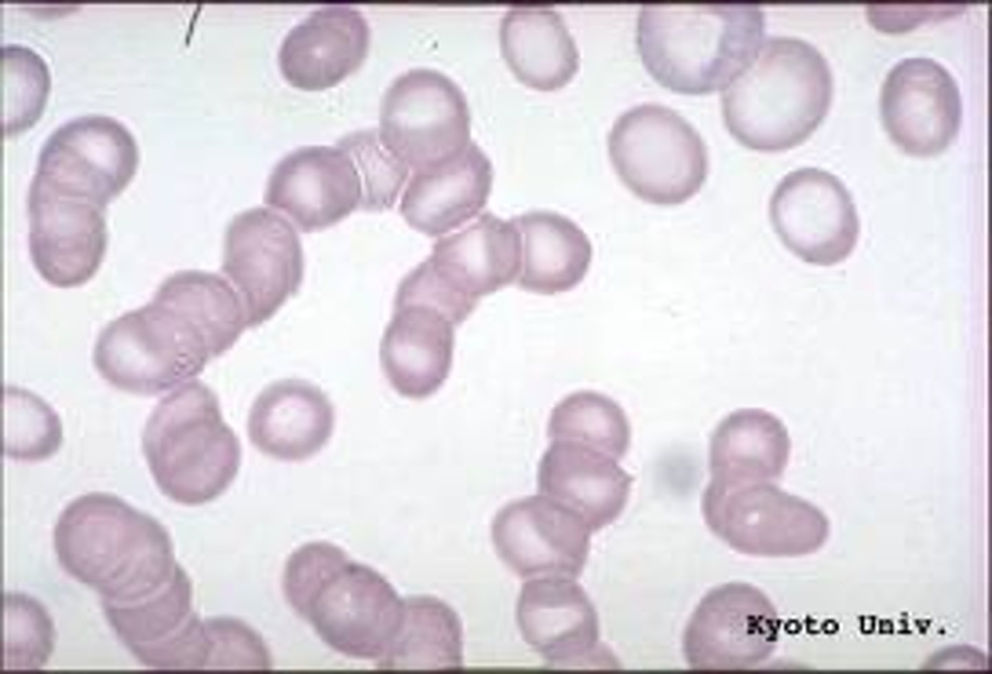 <p>a clump of red blood cells that appear to be stacked like a roll of coins</p>