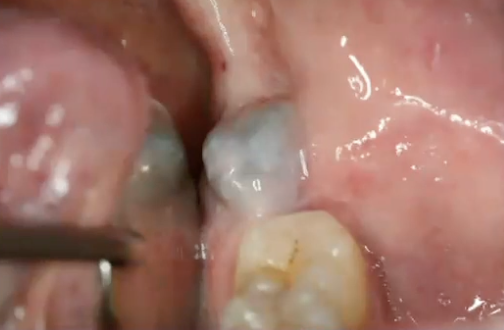 <p>What is the diagnosis?</p>