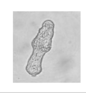 <p>What life cycle stage of schistosoma is this?</p>