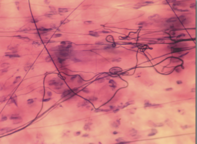 <p>a packing material that cushions and protects soft organs</p>