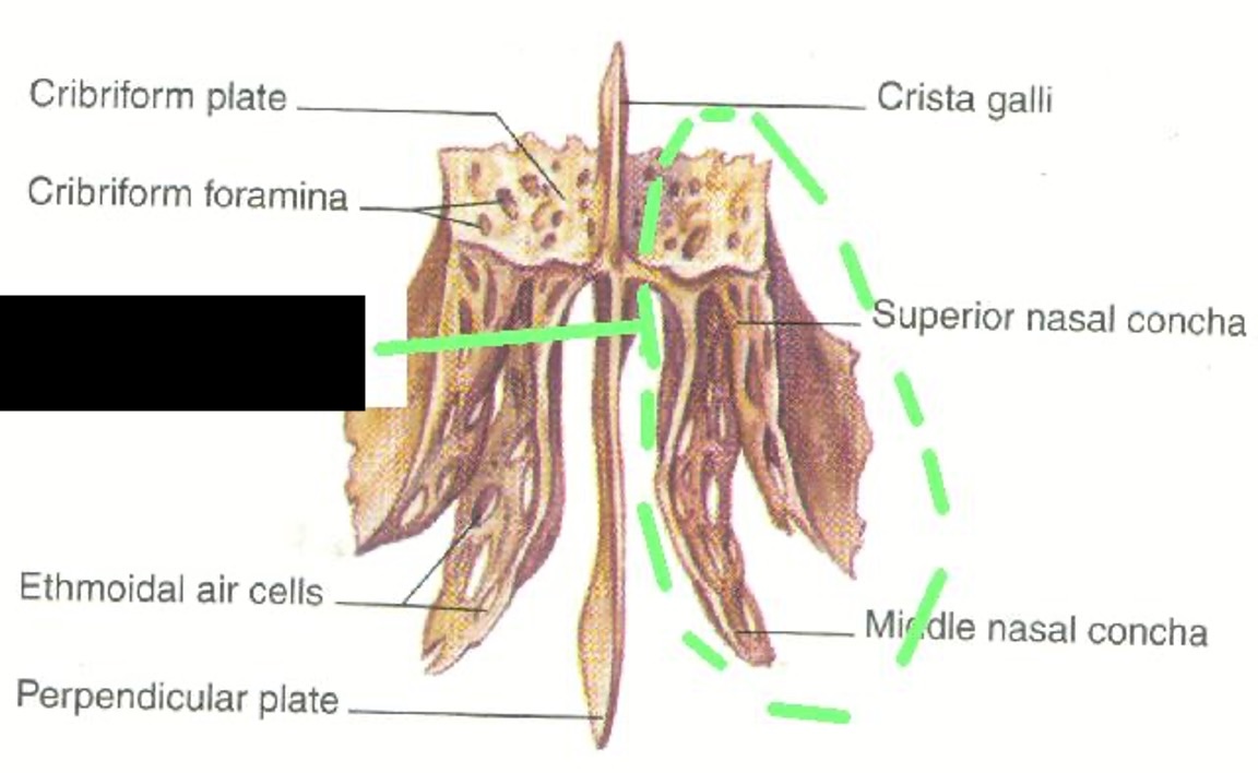 <p>the two flaps on each side of the Perpendicular Plate.</p>