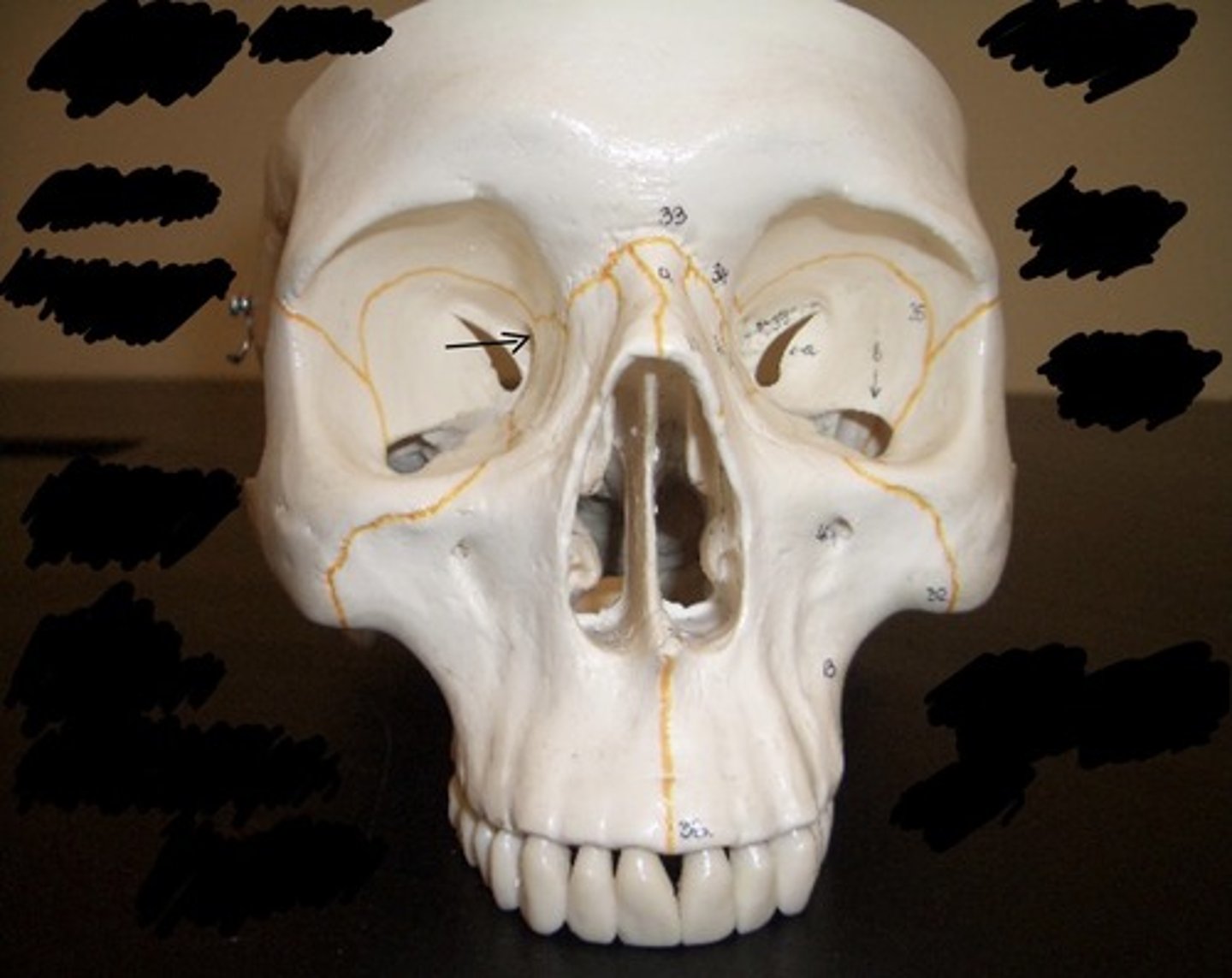 <p>What structure is pointed to here?</p>