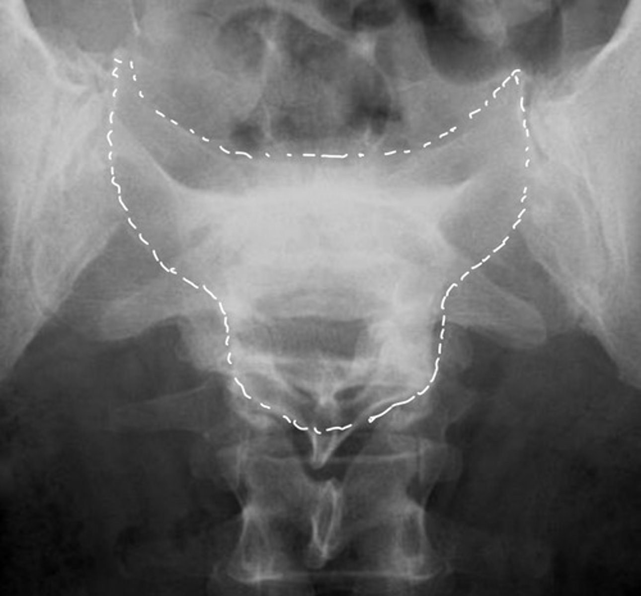 <p>This image was flipped upside down to depict what abnormality?</p>