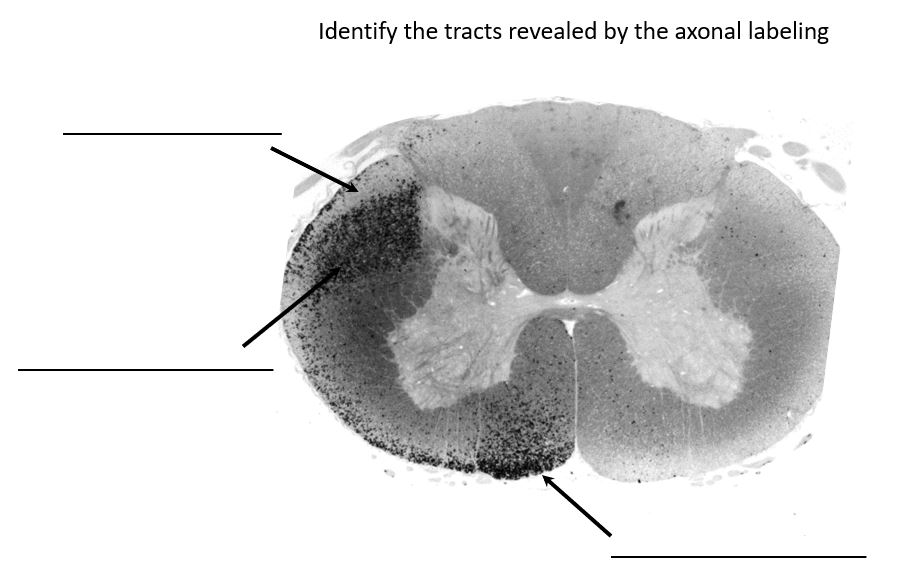 <p>identify the tracts revealed by axonal labeling</p>
