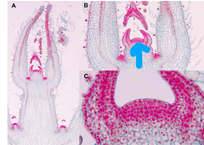 <p>What is the blue arrow pointing to</p>