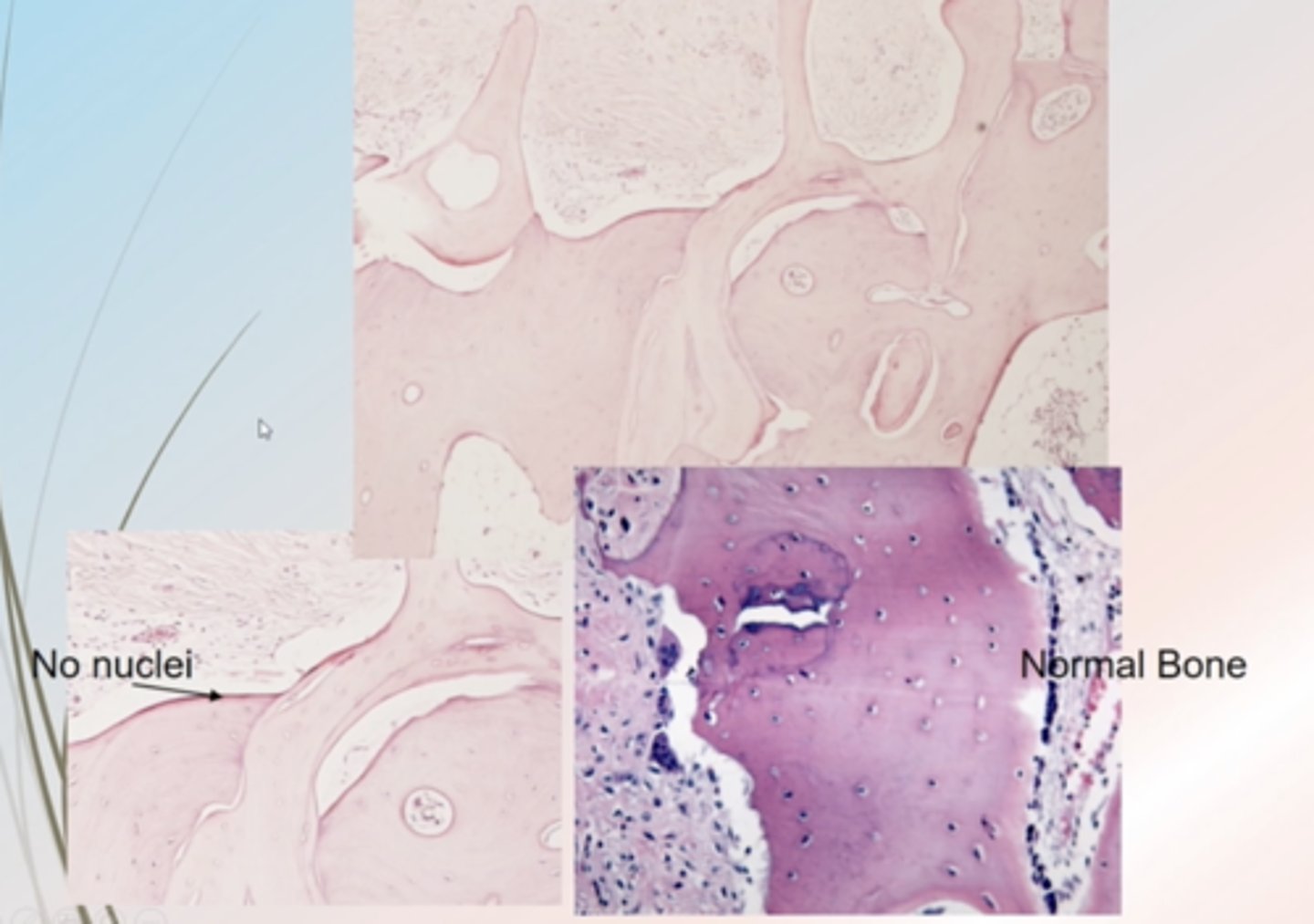 <p>No nuclei</p><p>No osteoblasts or osteoclasts</p>