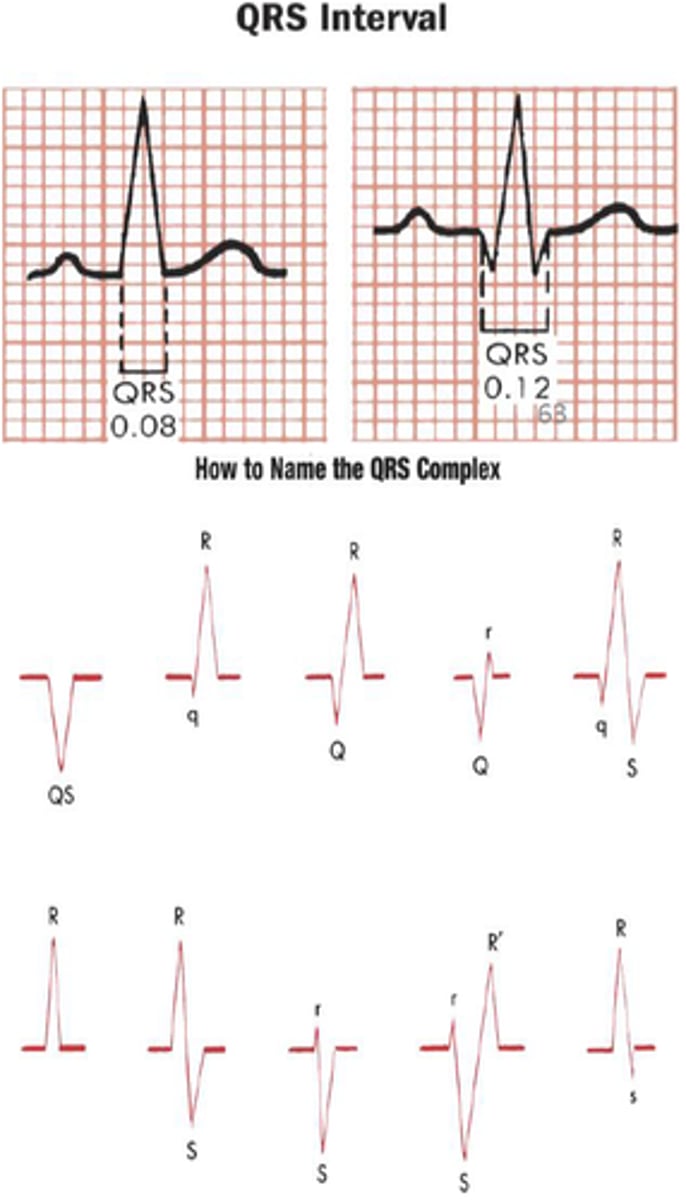 <p>- What is the width of the QRS complex? (Normally < 0.12 seconds)</p><p>- Are the QRS complexes within normal limits?</p><p>- Are all the QRS complexes of equal duration?</p><p>- Do all QRS complexes look alike?</p><p>- Are the unusual QRS complexes associated with ectopic beats?</p>