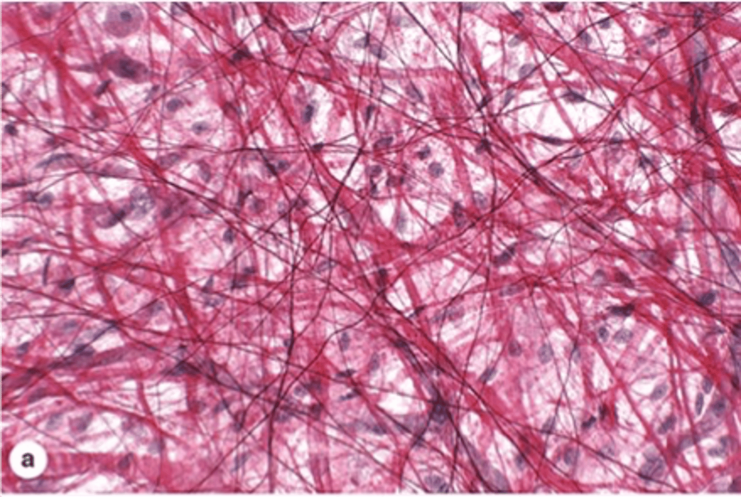 <p>Acidic dye staining cationic structures.</p>