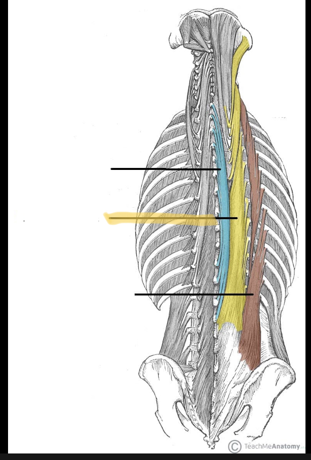 <p>Identify the highlighted muscle</p>